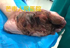 欧博官网下载-关于赛地聚焦——欧冠今晚热度飙升曼城强势反弹备战中超，媒体一致点评：尤文图斯迎国王杯关键赛的信息